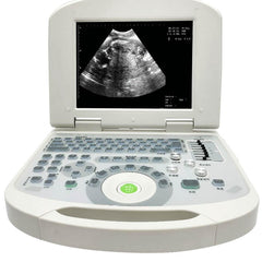 Portable all-digital notebook medical ultrasound scanner + convex array probe