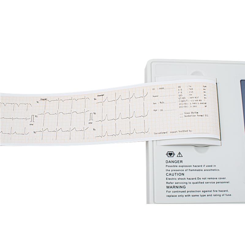 ECG machine Thermal paper roll for accurate ECG results, 80mm x 20m