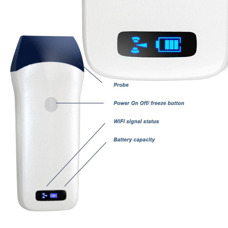 Wireless Color Doppler Ultrasound Scanner with 32 channels, 10Mhz frequency, 128 elements and 10m range