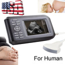 Portable Ultrasound Scanner - Handheld Convex Probe, 3.5MHz Frequency, 5.5" LCD Display