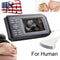 Portable Ultrasound Scanner - Handheld Convex Probe, 3.5MHz Frequency, 5.5" LCD Display