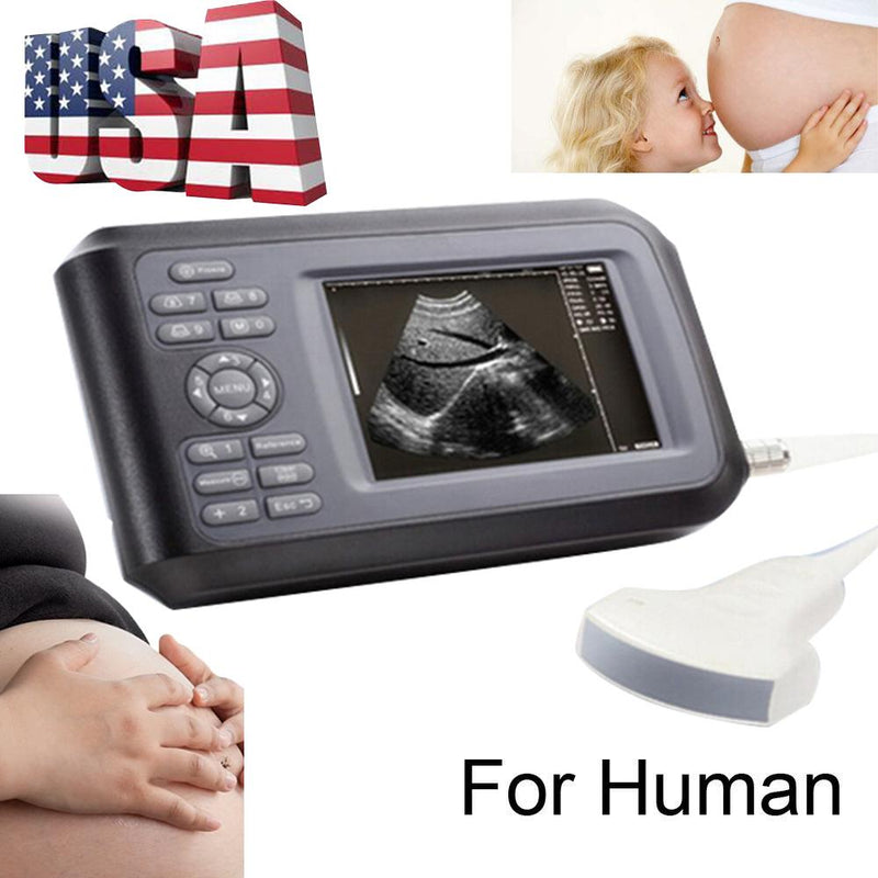 Portable Ultrasound Scanner - Handheld Convex Probe, 3.5MHz Frequency, 5.5" LCD Display