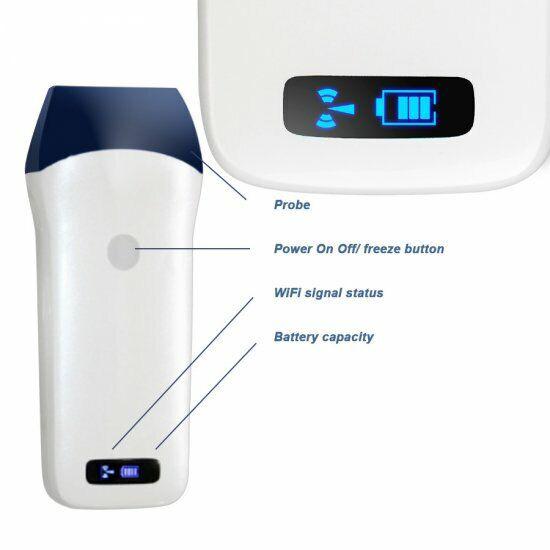 Wireless Color Doppler Ultrasound Scanner with 32 channels, 10Mhz frequency, 128 elements and 10m range