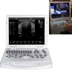 Portable ultrasound scanner with color Doppler convex probe and screen for 128 elements