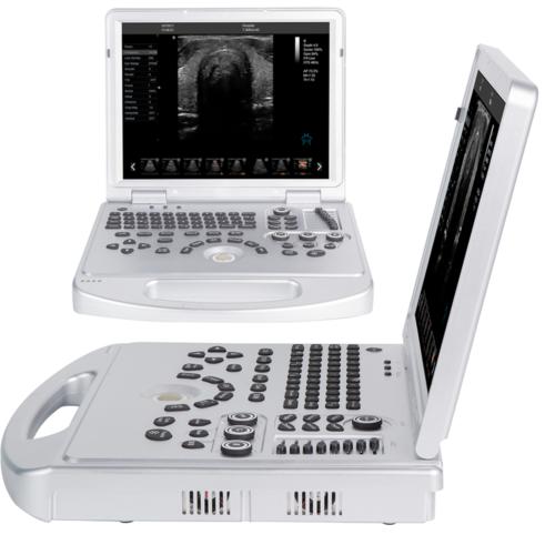 Portable ultrasound scanner with color Doppler convex probe and screen for 128 elements