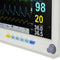12 Inch Multi-parameter Touch Screen Monitor ICU CCU Vital Sign Patient Monitor ECG NIBP RESP TEMP SPO2 PR