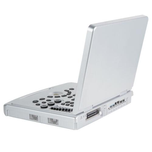 Portable ultrasound scanner with color Doppler convex probe and screen for 128 elements