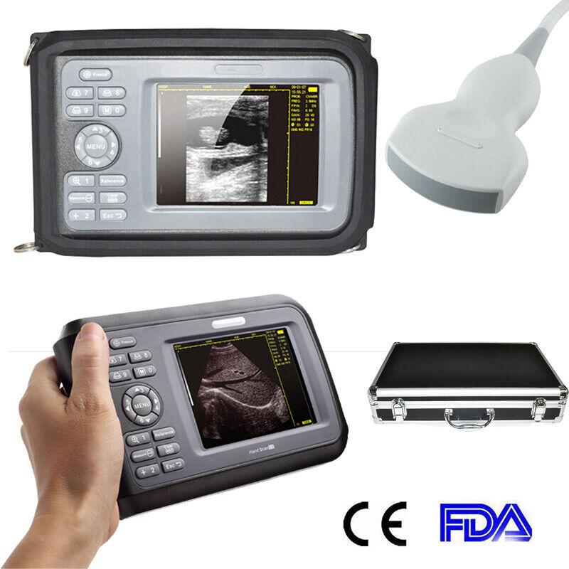 Portable Ultrasound Scanner - Handheld Convex Probe, 3.5MHz Frequency, 5.5" LCD Display