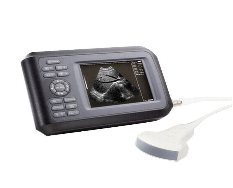 Portable Ultrasound Scanner - Handheld Convex Probe, 3.5MHz Frequency, 5.5" LCD Display