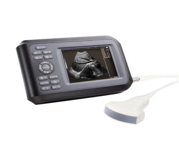 Portable Ultrasound Scanner - Handheld Convex Probe, 3.5MHz Frequency, 5.5" LCD Display