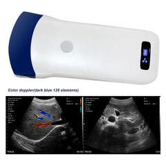 Wireless Portable Ultrasound Scanner - Color Doppler Convex Probe, Clear Imaging, 128 Elements and WiFi Connectivity
