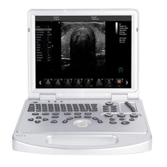 Portable ultrasound scanner with color Doppler convex probe and screen for 128 elements