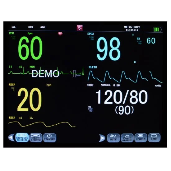Portable 12.1" Touch Screen Patient Monitor Vital Signs