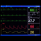 8 Inch ICU CCU Vital Sign Patient Monitor 6 parameter ECG NIBP RESP TEMP SPO2 PR