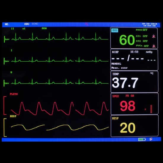 8 Inch ICU CCU Vital Sign Patient Monitor 6 parameter ECG NIBP RESP TEMP SPO2 PR