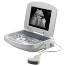 Portable Full Digital Laptop Medical Ultrasound Scanner Convex Probe