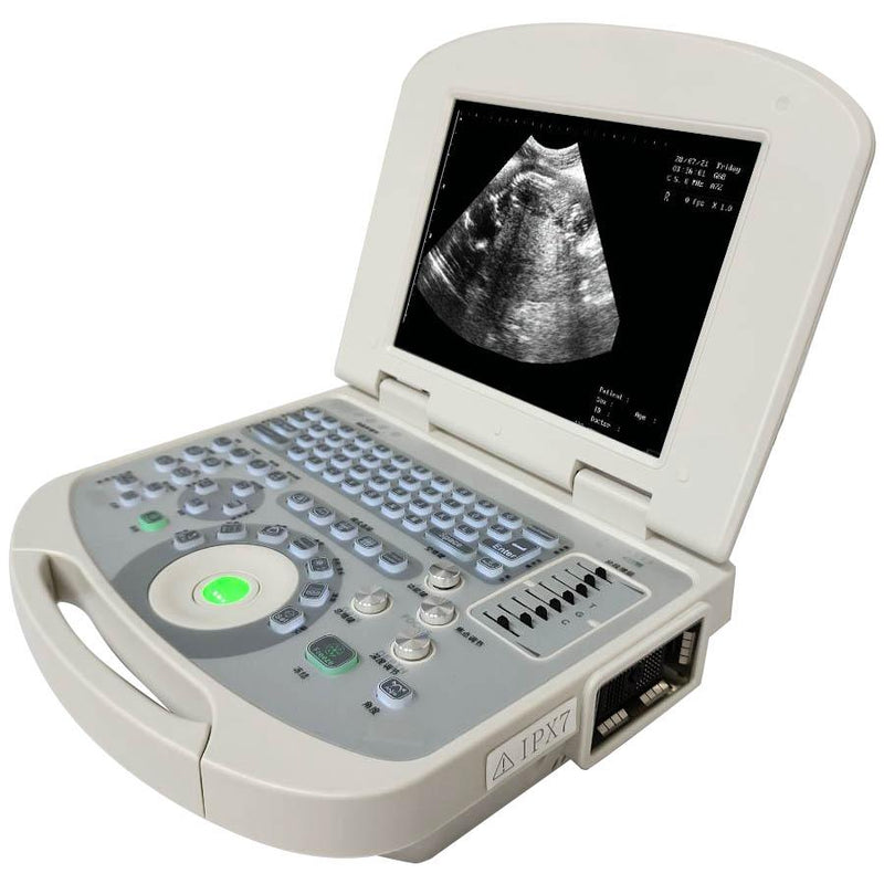 Portable all-digital notebook medical ultrasound scanner + convex array probe