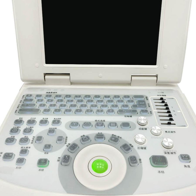 Portable all-digital notebook medical ultrasound scanner + convex array probe