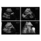 Portable all-digital notebook medical ultrasound scanner + convex array probe