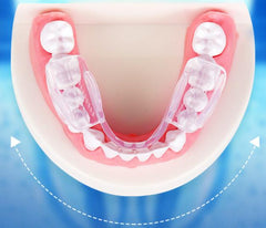 2PCS/BOX Silicone Stop Molar Anti Snore Mouthpiece Apnea Guard Bruxism Tray Sleeping Aid